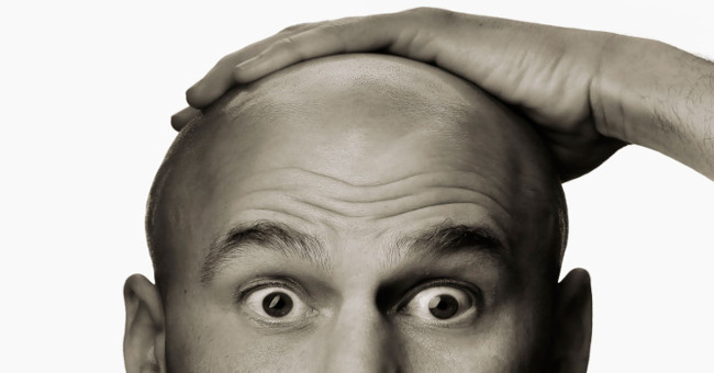 Scientists unknowingly found a way to break the baldness