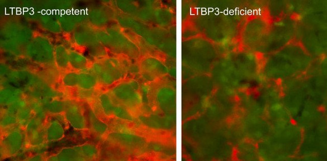 Scientists who find proteins can prevent metastatic cancer