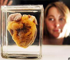 See show your own heart