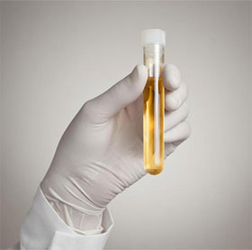 See your urine to see if you are fine or weak