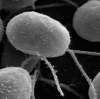 Seek blindness treatment for algae