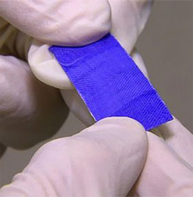 Self-biodegradable stickers support the surgical process