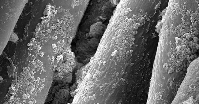 Self-regulating clothes against dermatitis