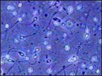 Semen can promote cervical cancer