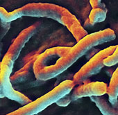 Senegal confirmed the first case of Ebola infection was an international student