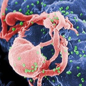Sensitivity detection of HIV with the naked eye