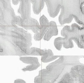 Set up the first 3D model of the human brain