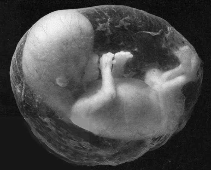 Sex detection of 5-week-old fetus