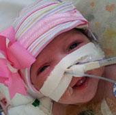 She was born with a heart outside her body
