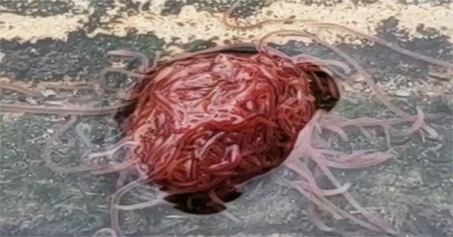 Shivers of 'worm bun' like the human brain
