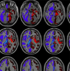 Shocking discovery about the left brain and right brain
