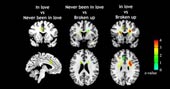 Shooting the brain may indicate the person in love