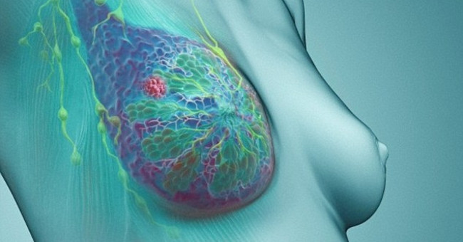 Signs of some common types of cancer