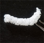 Silk containing adenosine promises epilepsy