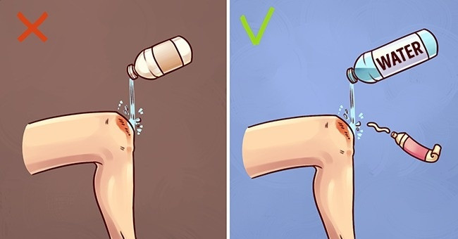Simple first aid tips but 90% of people make mistakes when urgent