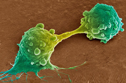 Singapore discovered how to kill new cancer cells