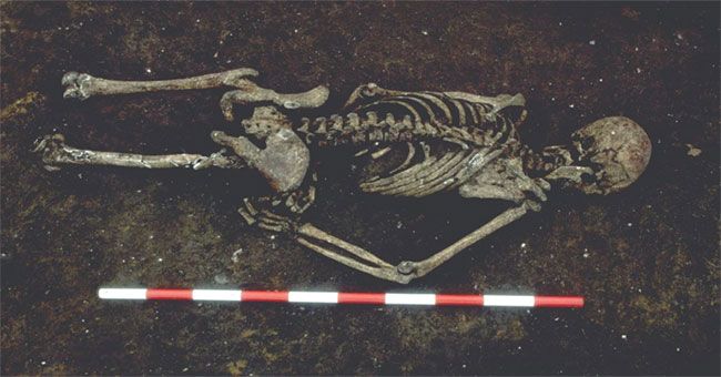 Skeleton man lost tongue over thousand years in England