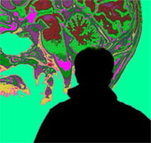 Skeptics are more likely to develop dementia