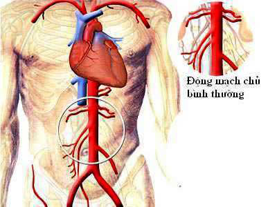 Skin: Raw material to produce blood vessels