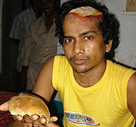 Skull fell, people still live