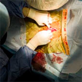 Small heart pacemakers and wireless charging
