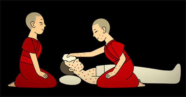 Smallpox kills billions of people and how medicine defeats them!