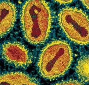Smallpox virus can kill cancer cells