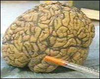 Smart 'other development' human brain