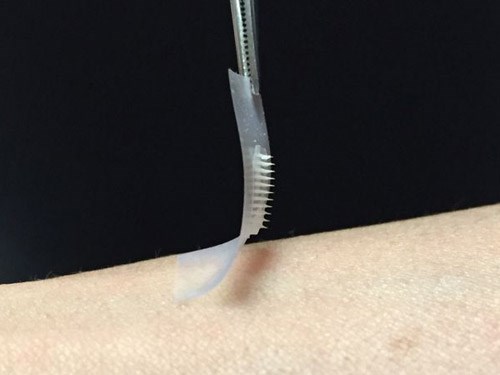 Smart stickers for diabetics