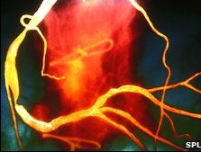 Smoking, eating high cholesterol makes men die 10 years early