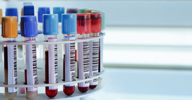SoftBank and many other companies invest billions of money into cancer testing technology with blood