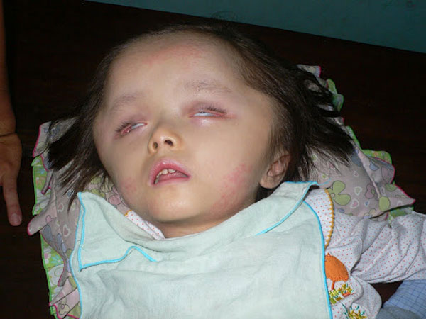 Soothe 'Orange pain' in 2012