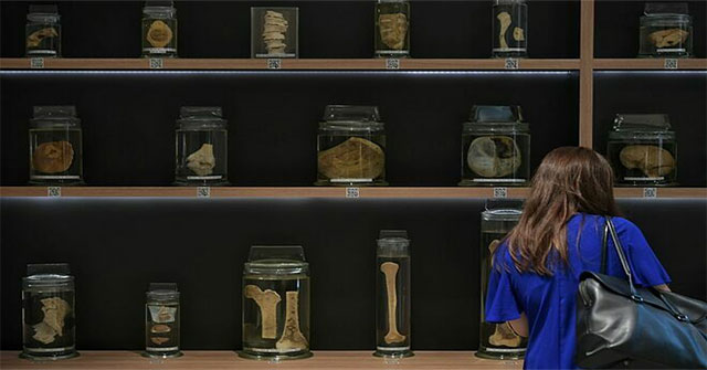 Southeast Asia's first brain bank was born
