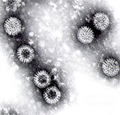 Special test system for diagnosing infectious diseases