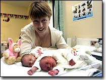 Special twins were born in England