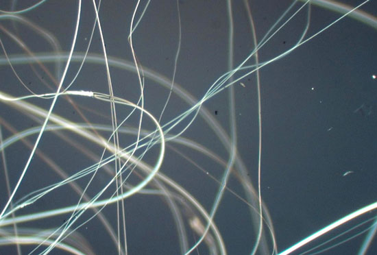 Spider silk can save burns