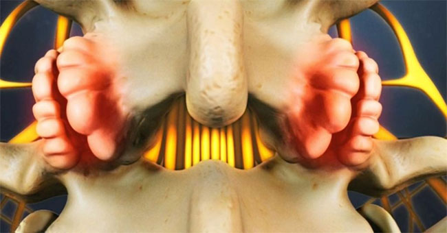 Spine spine - dangerous disease but difficult to detect early