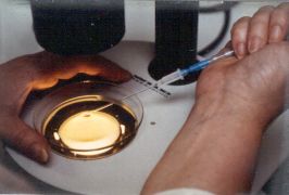 Starch culture for infertile men