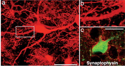 Stem cell method helps treat Parkinson's disease in rats