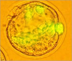 Stem cell: The hard copy