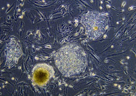Stem cells can treat neurological disorders