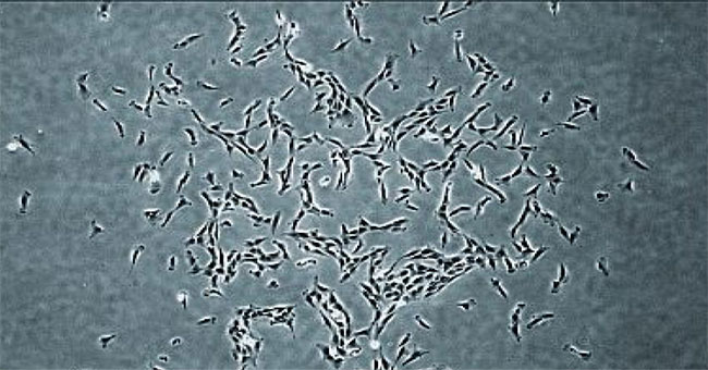 Stem cells in human bones can renew themselves