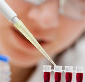 Stem cells will be taken to the ISS station for observation