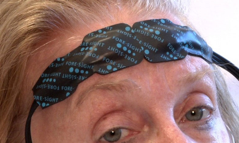 Stickers to monitor stroke patients