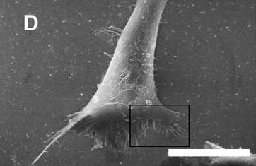 Stimulating nerve impulses with nanoparticles