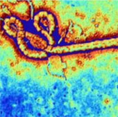 Stop testing Ebola vaccine due to side effects