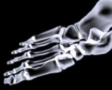 Stories about scientists find X-rays and radiation