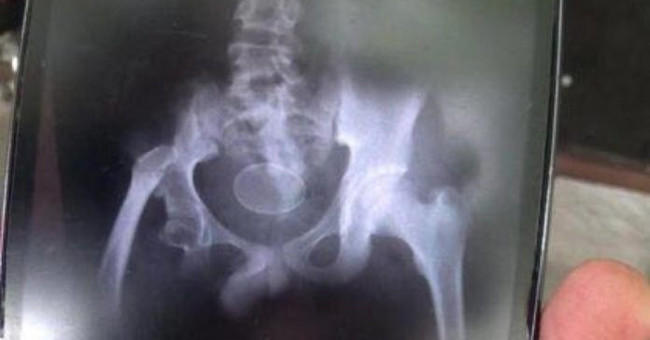 Strange 12-year-old boy a week ... laid out 7 eggs?