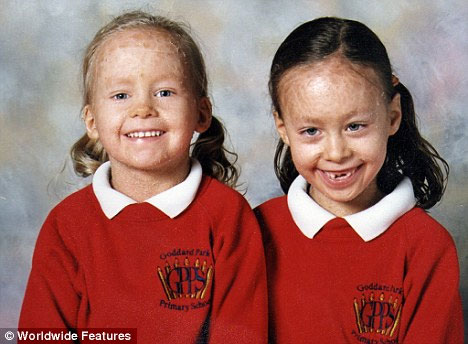 Strange 2 sisters skinned like a snake