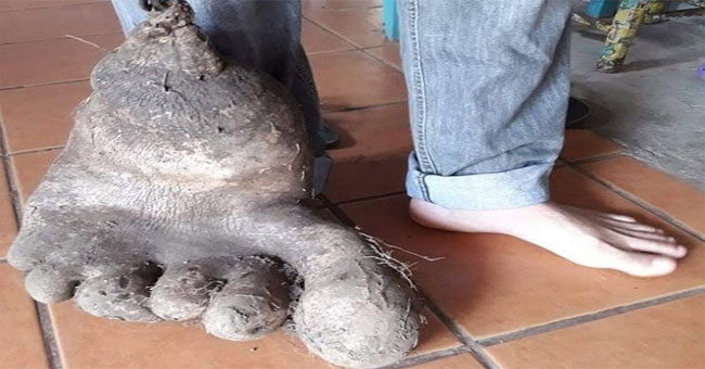 Strange 8kg potatoes, just like giant feet